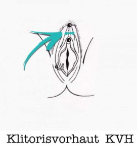 KlitorisVorhaut-Horizontal-KVH-piercing-ABC-Benztown-ink-station-stuttgart-piercingstudio Intim Piercings