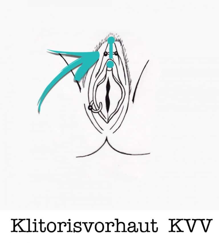 KlitorisVorhaut-Vertikal-KVV-piercing-ABC-Benztown-ink-station- Intim Piercings stuttgart-piercingstudio