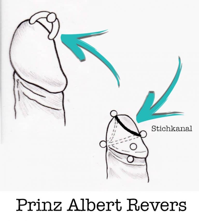 Prinz-albert-revers-PA-piercing-piercing-ABC-Benztown-ink-station-stuttgart-piercingstudio. Intim Piercings